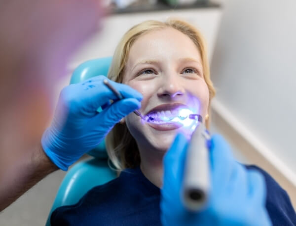 dis-beyazlatma-resim-5