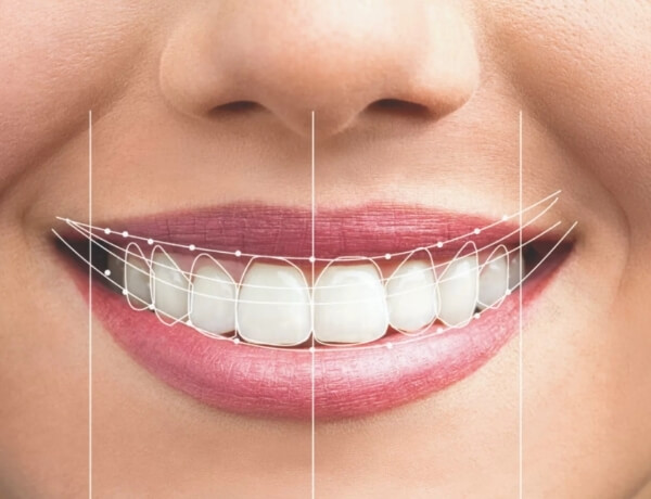 estetik-gulus-tasarimi-resim-2